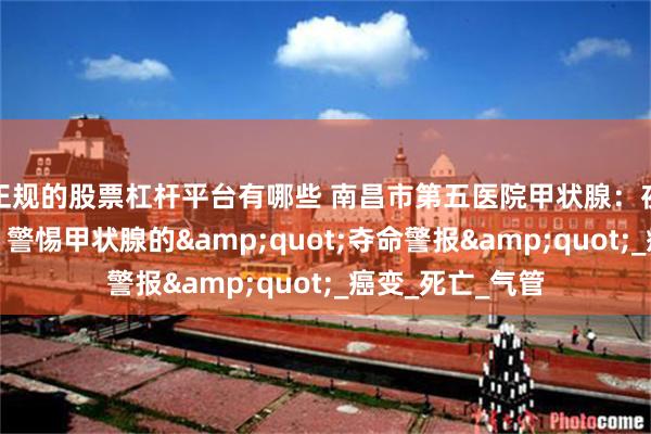 正规的股票杠杆平台有哪些 南昌市第五医院甲状腺：夜半胸闷别硬扛！警惕甲状腺的&quot;夺命警报&quot;_癌变_死亡_气管